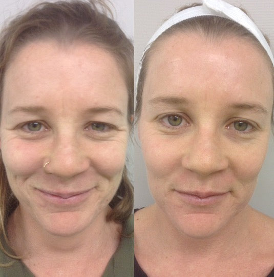 BISTRO KITCHEN TOWEL-SET OF 3